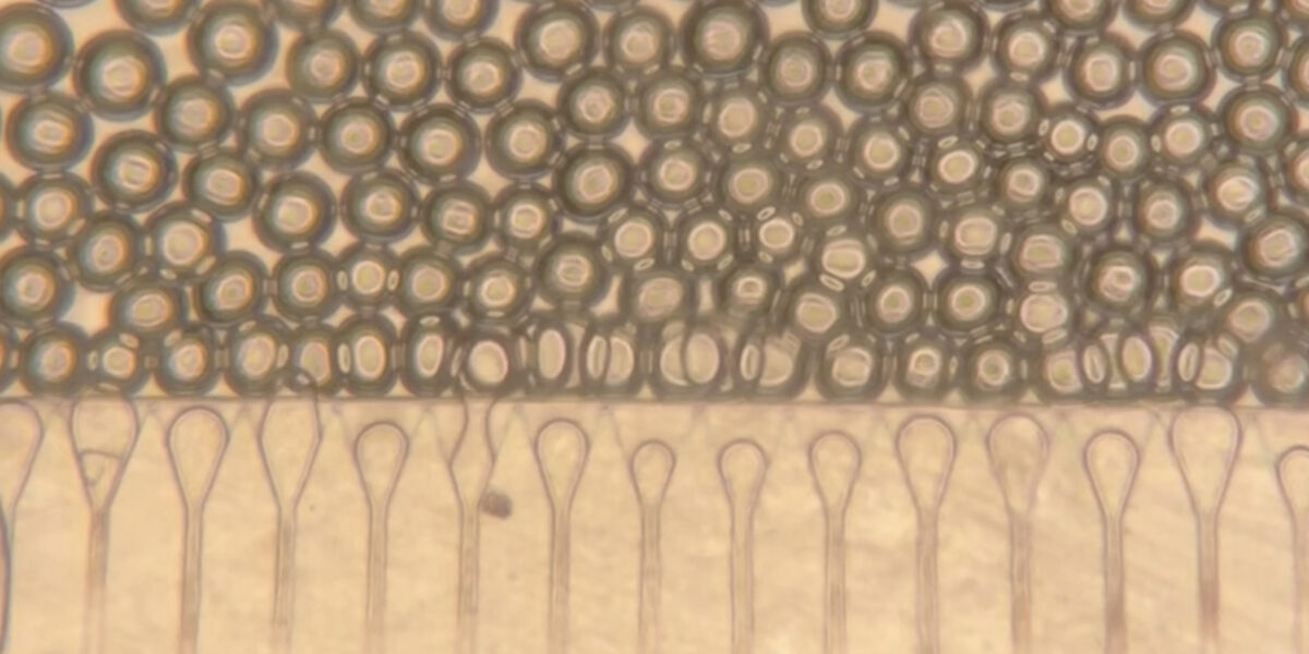 MIT’s injectable mini livers could help patients who can’t get a transplant