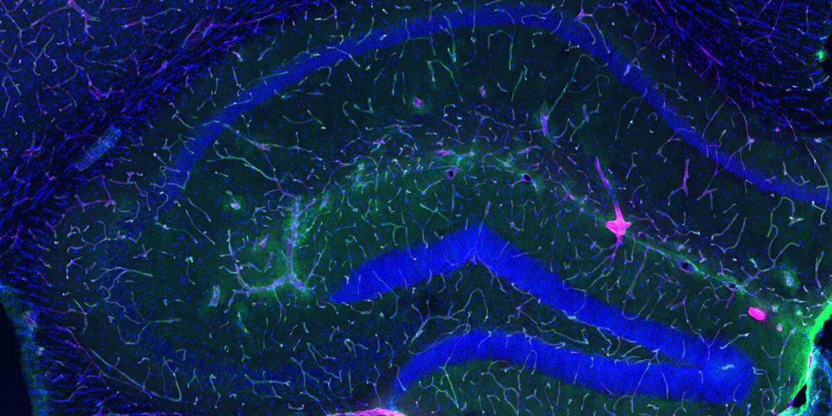 The blood-brain barrier (green line) in a young animal prevents most of an injected dye (pink) from reaching the brain.