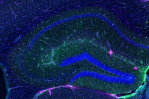 Scientists uncover how exercise may protect the aging brain by repairing its “leaky” vascular shield