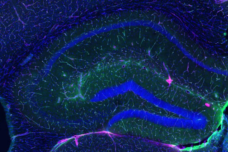 Scientists uncover how exercise may protect the aging brain by repairing its “leaky” vascular shield